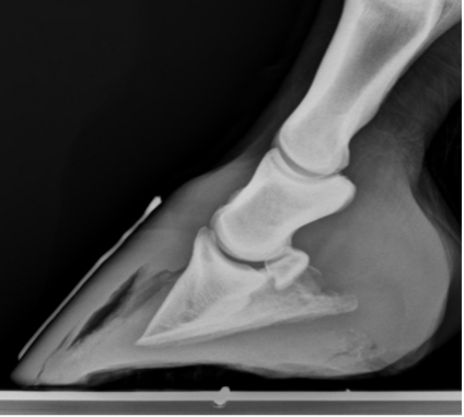 Lateral foot radiograph