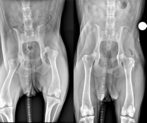 Radiographs show a patient's displaced hip before surgery, and after her toggle procedure. The prosthetic ligament is visible in the lower right. 