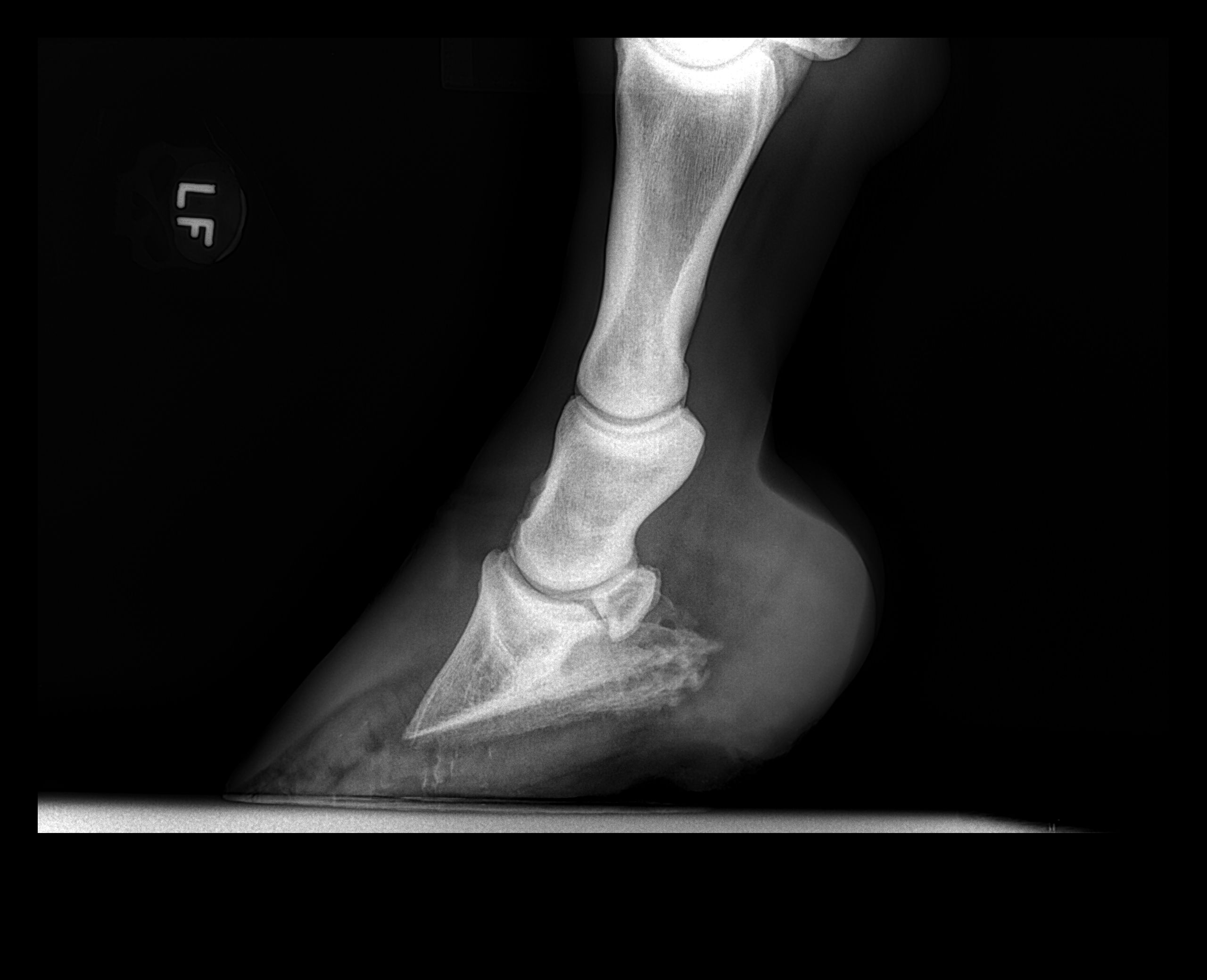 X-ray of laminitic hoof with significant coffin bone rotation