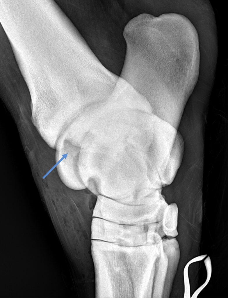 Hock OCD Radiograph Postop