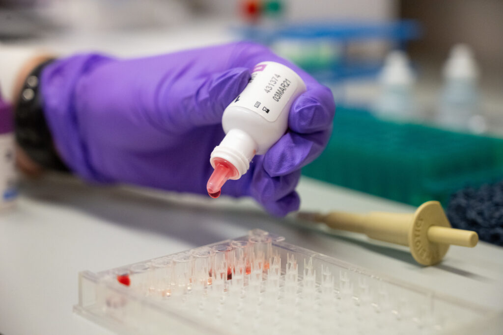 purple gloved hand holds dropper bottle above sample tray