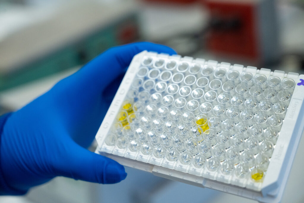 A hand with blue latex glove holds a box of samples in the TSE section of the veterinary diagnostic lab