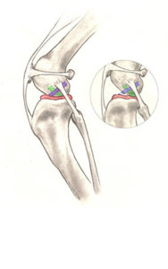 ruptured cranial cruciate ligament