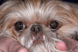 Post medial canthoplasty