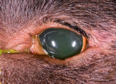 Postoperative entropion (1)