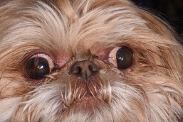 Pre medial canthoplasty (1)