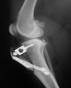 X ray after tta procedure