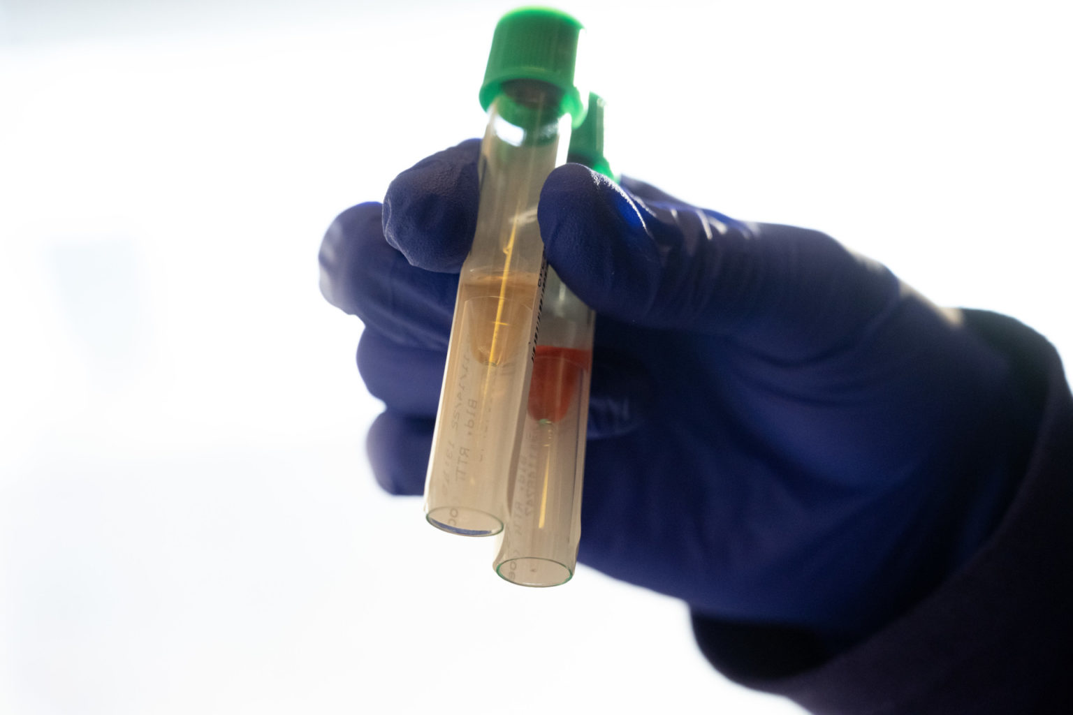 gloved blue hand holds two green-lidded test tubes; one with yellow liquid inside, the other with red liquid inside