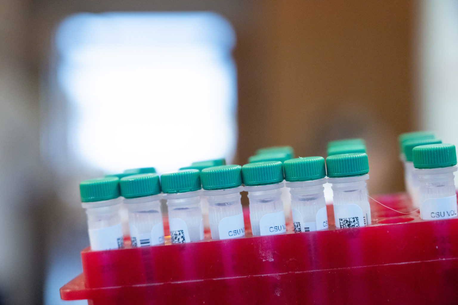 upright tubes in a red holder