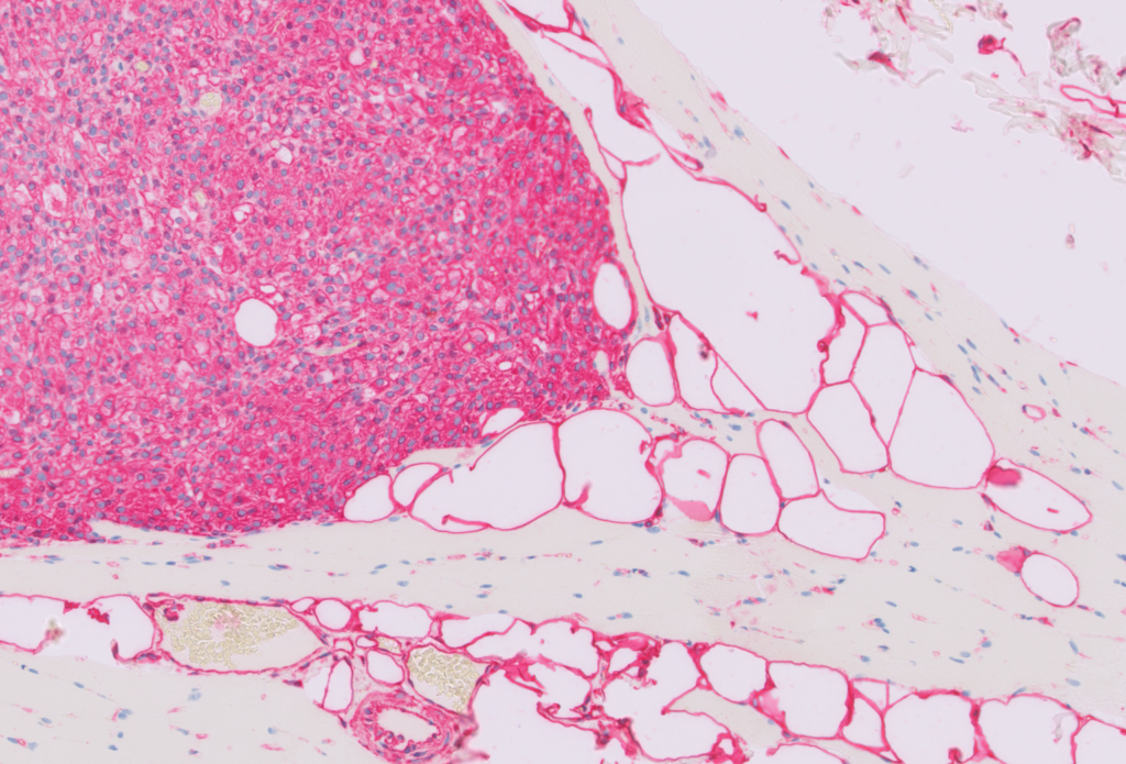 immunohistochemistry image