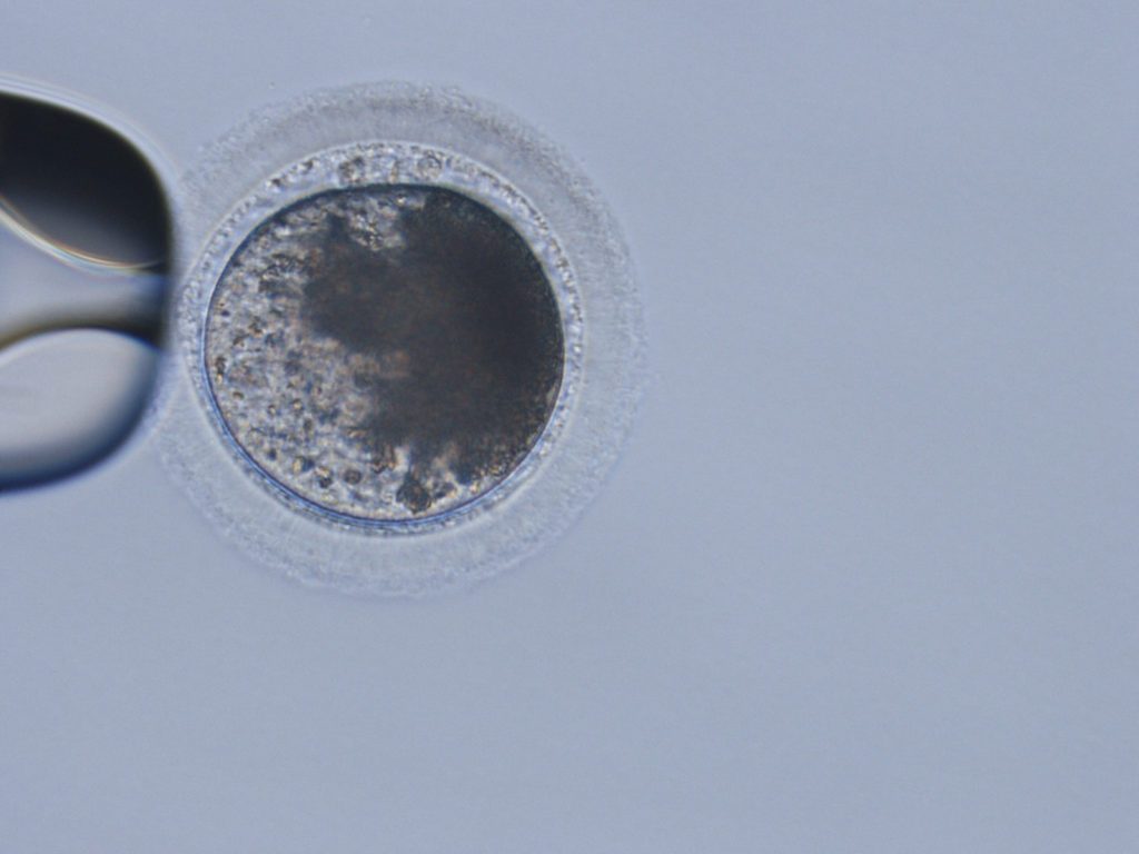 microscopic image of an oocyte