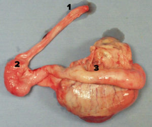 Photograph of testis, epididymis and vas deferens.