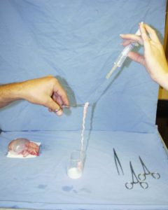 Sperm is being harvested from the vas deferens and tail of the epididymis.