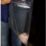 plastic bag with rinsed ovary inside