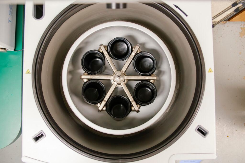 Centrifuge where blood is spun into red blood cells and plasma